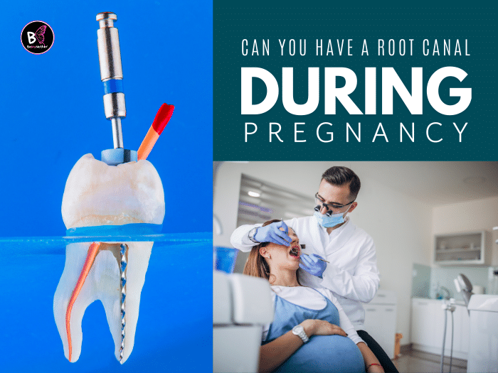 Can You Have a Root Canal During Pregnancy