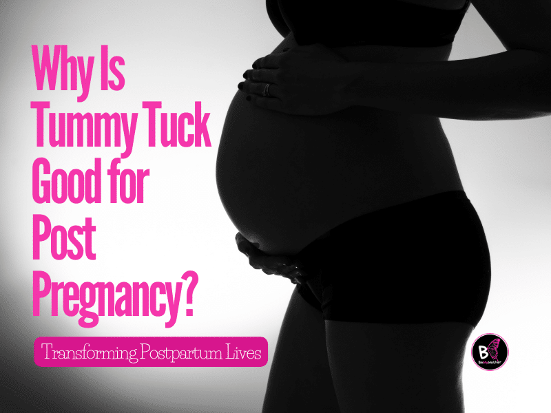 Why Is Tummy Tuck Good for Post Pregnancy