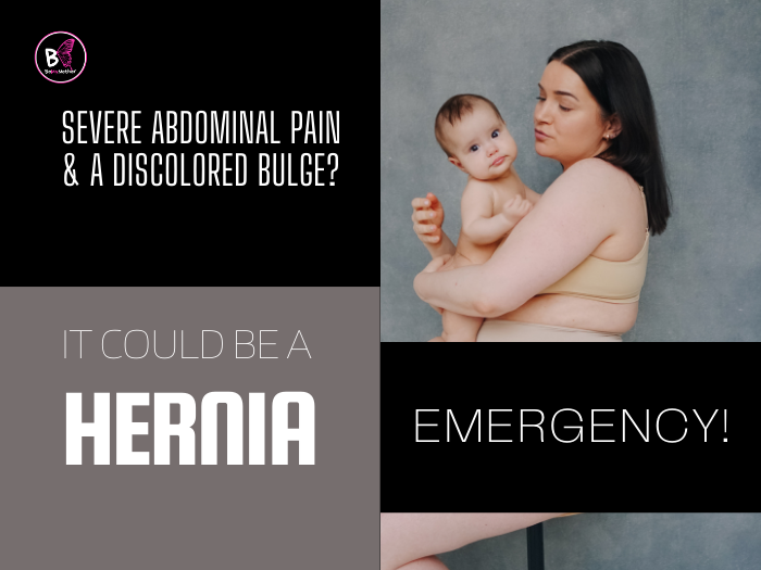 Hernia After Pregnancy Severe Abdominal Pain & a Discolored Bulge? It Could Be a Hernia Emergency!