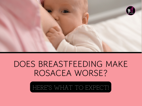 Rosacea Treatments During Pregnancy: Whatβs Safe & Whatβs Not? Rosacea and Pregnancy