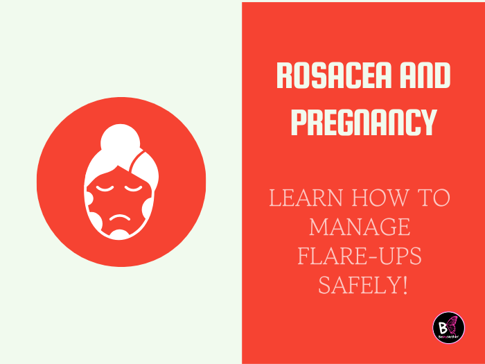Rosacea and Pregnancy